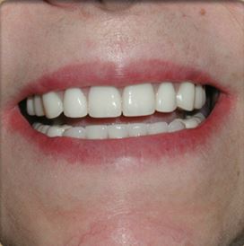 Dr. Daher Patient Testimonial