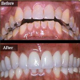 Dr Daher Testimonial